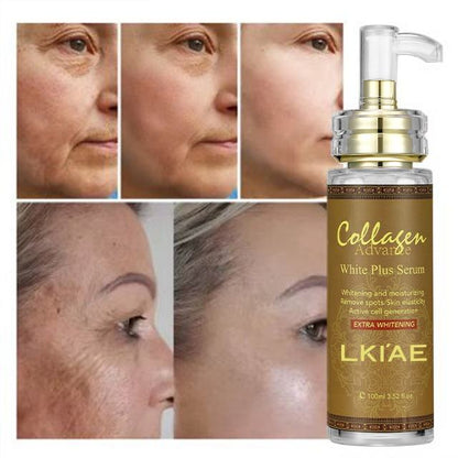 OEM ODM AILKE Tea Tree Whitening Vitamin E Facial Serum Skin Care Private Label Anti Acne Serum for Face