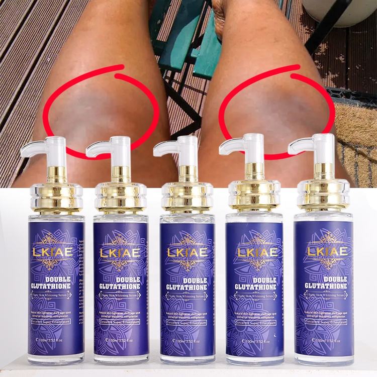 OEM ODM AILKE Tea Tree Whitening Vitamin E Facial Serum Skin Care Private Label Anti Acne Serum for Face